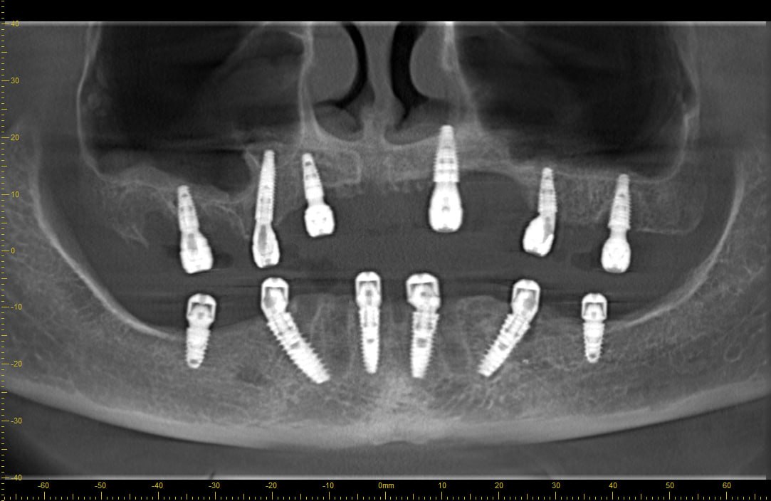3D Diagnostics