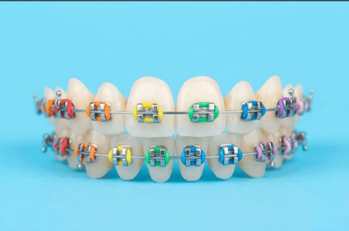 Orthodontics