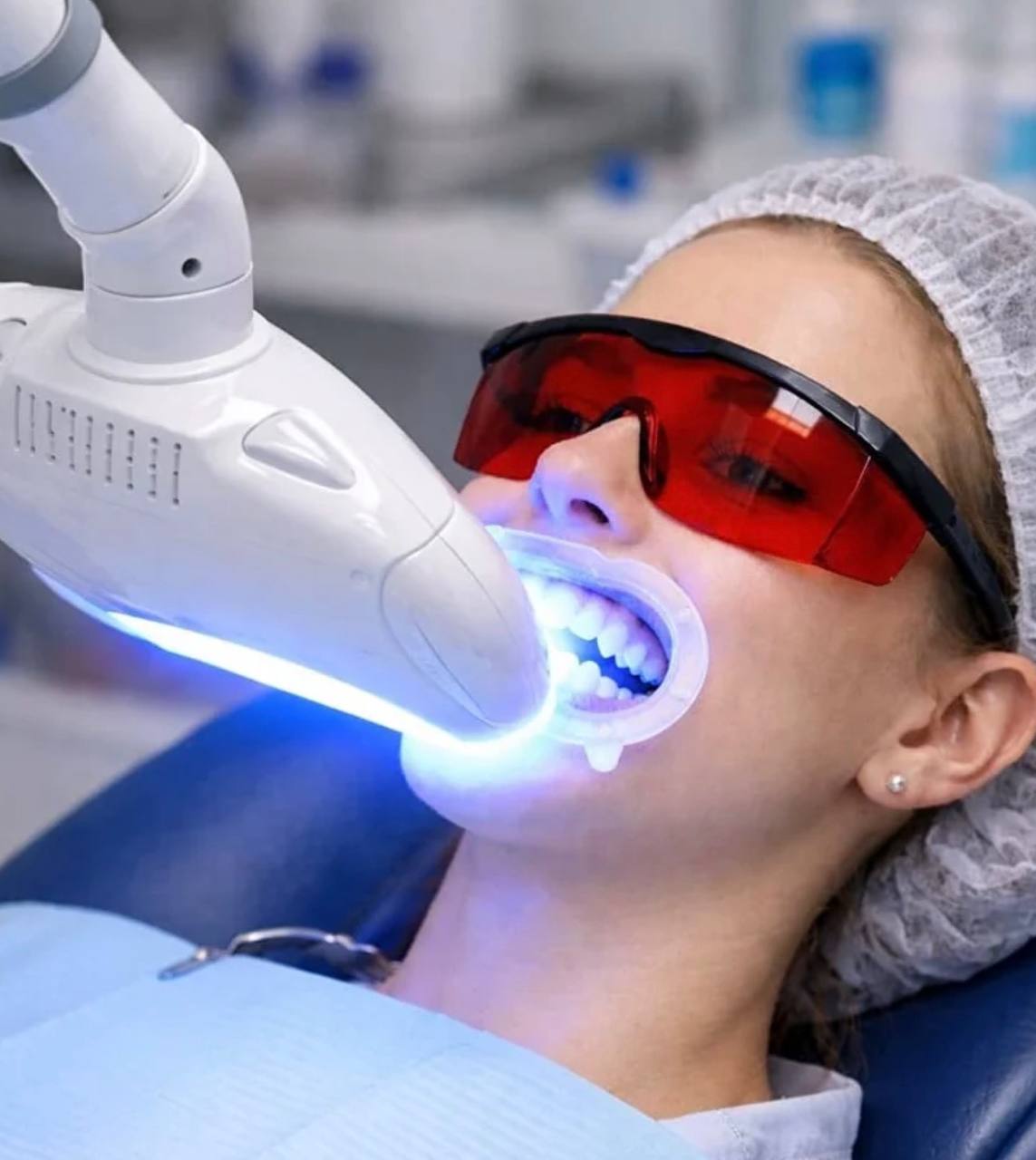 Laser Whitening